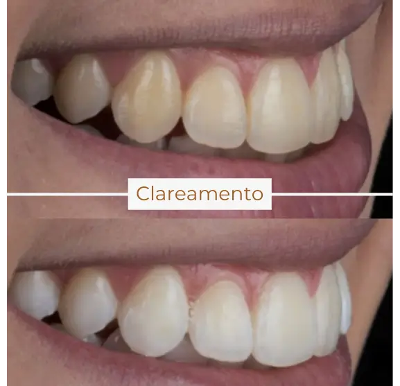 Site - Greicy Fiuza (10)